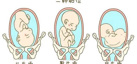 4种胎位图解，孕30周这个姿势最适合顺产-孕多多