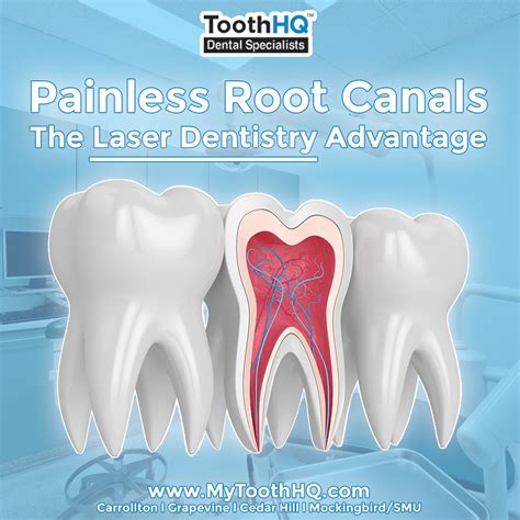 Painless Root Canal With Laser Therapy | ToothHQ | Texas