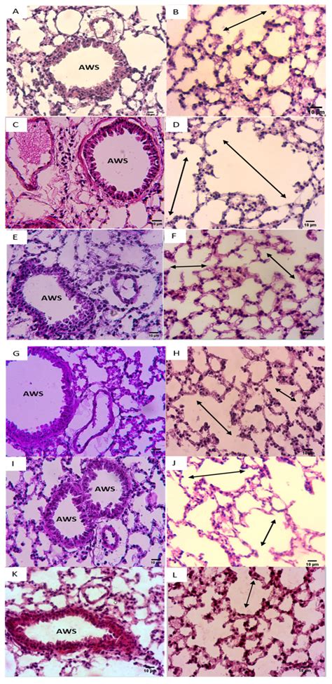 NADH Intraperitoneal Injection Prevents Lung Inflammation in a BALB/C ...