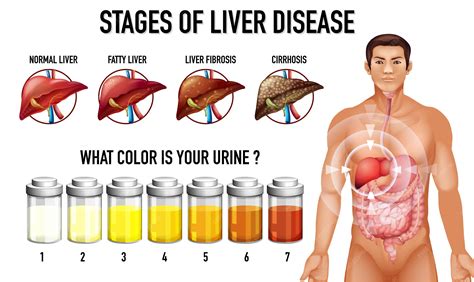Liver Pain Symptoms Location