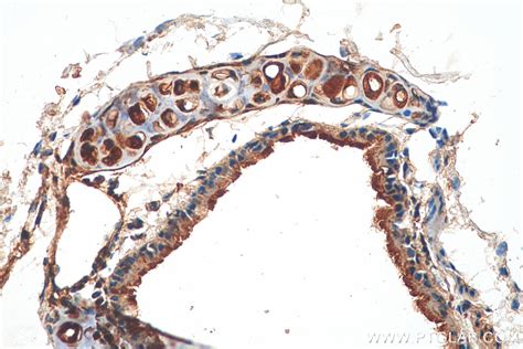 PI3 Kinase p85 Alpha antibody (60225-1-Ig) | Proteintech