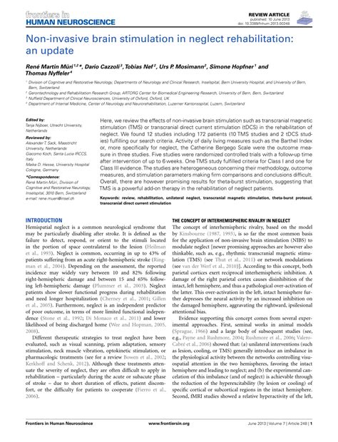 Image result for Non-Invasive Brain Stimulation