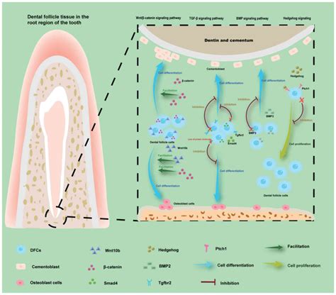 Abnormal dental follicle cells: A crucial determinant in tooth eruption disorders (Review)