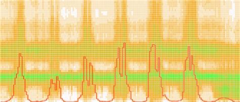 Image result for Audio Bee Test Answers