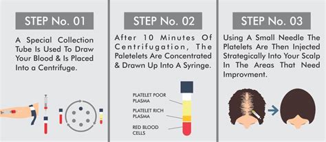 PRP-Platelet Rich Plasma | Regain Hair Clinic