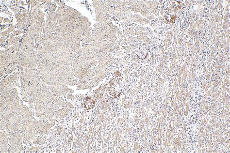 LSM12 antibody (67029-1-Ig) | Proteintech