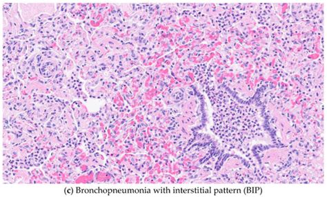 Determining Frequency of Common Pulmonary Gross and Histopathological ...