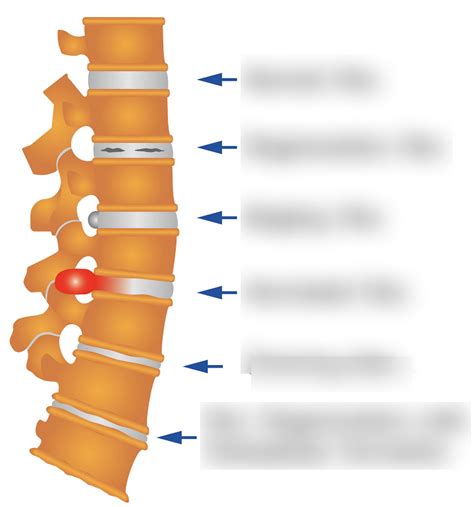 Disk Problem 的图像结果