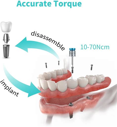 BUIFAC Dental Implant Kit, Universal Prosthetic Torque India | Ubuy