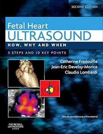 Buy Fetal Heart Ultrasound: How, Why and When Book Online at Low Prices ...