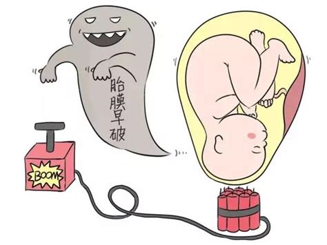 NT检查，孕妈妈一定要知道的胎儿排畸第一关！ | 新闻资讯 | 广州爱博恩医疗集团有限公司