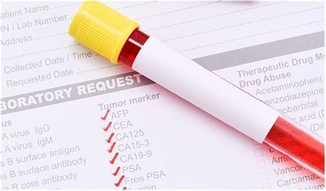 Metabolomics Biomarker Market SWOT Analysis and Development Strategy ...