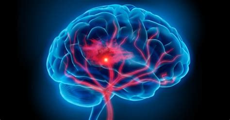 New Drug Reverses Brain Damage Caused By Concussion