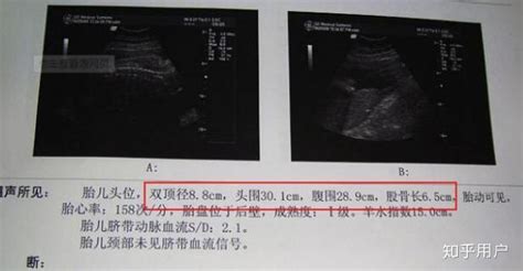 孕周胎儿发育标准值对照表_32周时偏小两周，今天要去复查B超_宝宝树