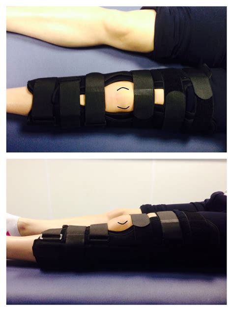 Dislocated Kneecap Brace