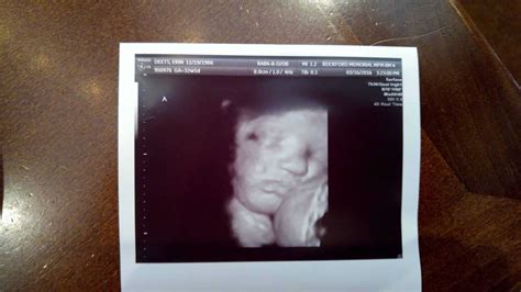 32 Weeks Pregnant Ultrasound
