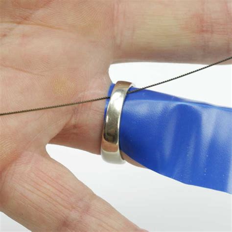Image result for Ring Removal String Technique