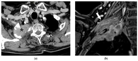 Clinical TNM Lung Cancer Staging: A Diagnostic Algorithm with a ...