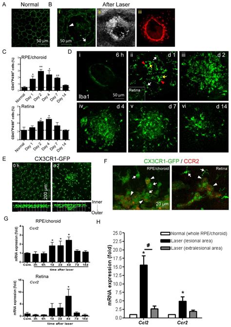 Image result for RPE Hexagonal Structure