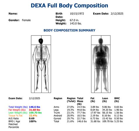 Image result for Dexa Scan Interpretation