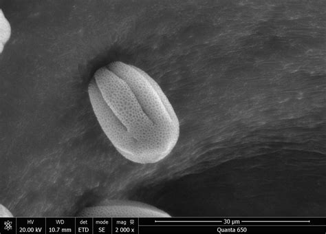 Image result for Flower Pollen Under Microscope