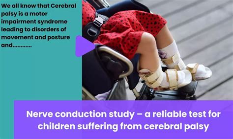 Journal Club: Nerve conduction study-a reliable test for children ...