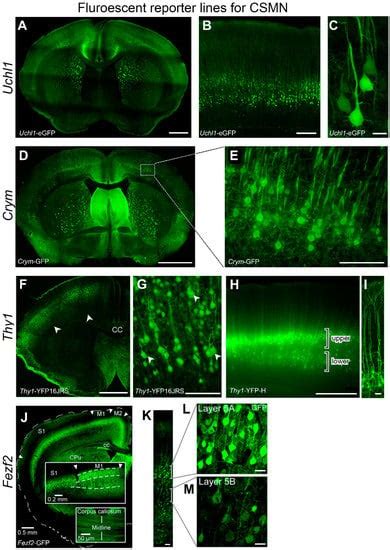 Complexity of Generating Mouse Models to Study the Upper Motor Neurons ...
