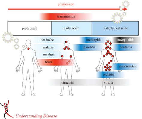 Image result for Mumps Operating System Computer Science