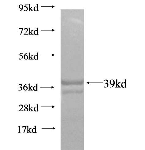 KRT2 Fusion Protein Ag16384 | Proteintech