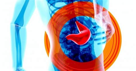 Study finds reason, cure for cancer in immunotherapy-induced colitis ...