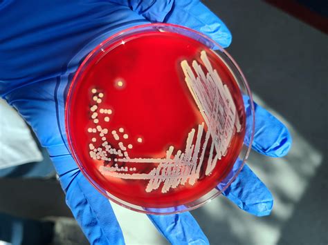 Blood Agar Staphylococcus Aureus