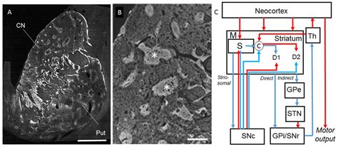 Striatal Vulnerability in Huntington’s Disease: Neuroprotection Versus ...