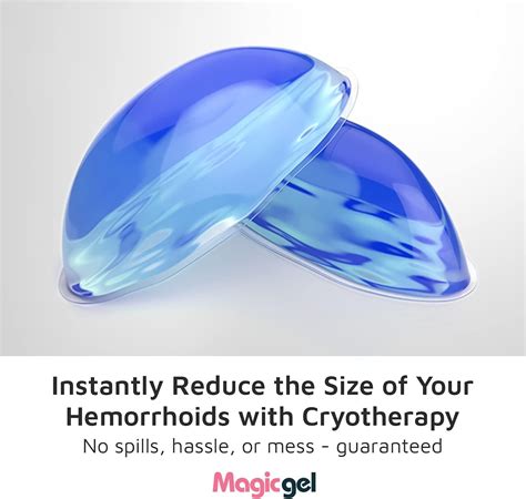 External Hemorrhoids Treatment Ice Pack at Roberto Stiefel blog