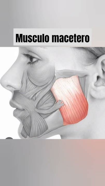 Image result for Masseter Muscle Trigger Point