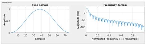 Structural Anomalies Detection from Electrocardiogram (ECG) with ...