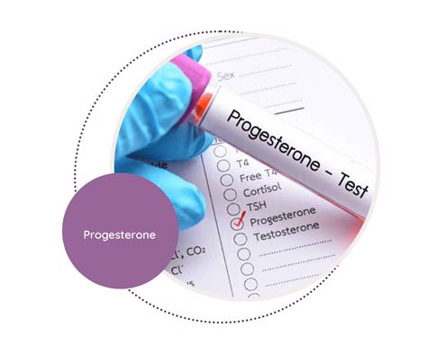 Progesterone Challenge Test 的图像结果