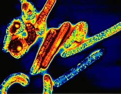 Life Technologies India: - FBS (foetal bovine serum, Fetal Bovine Serum ...