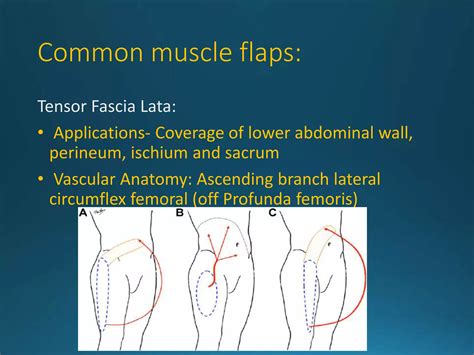 Flaps in surgery | PPTX