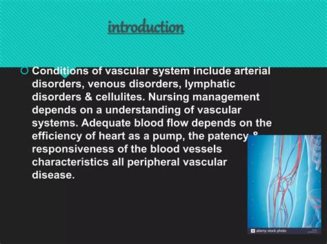 Understanding Disorders Of Vascular System Ppt
