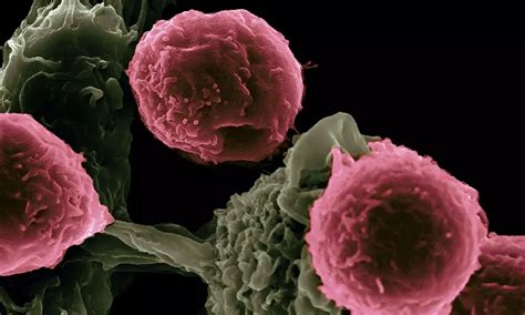 New study unravels role of interferon gamma in autoimmune polyendocrine ...