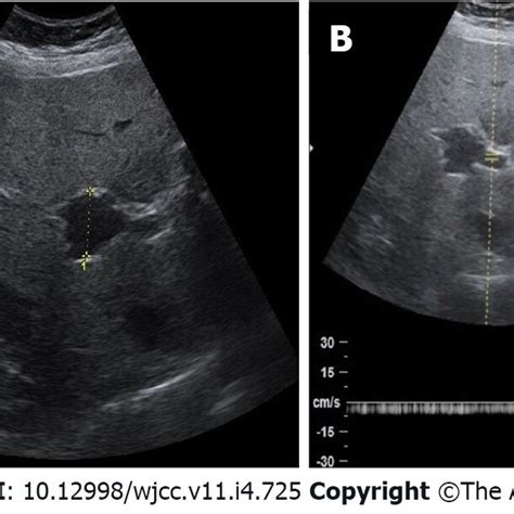 Image result for Ultrasound Lab