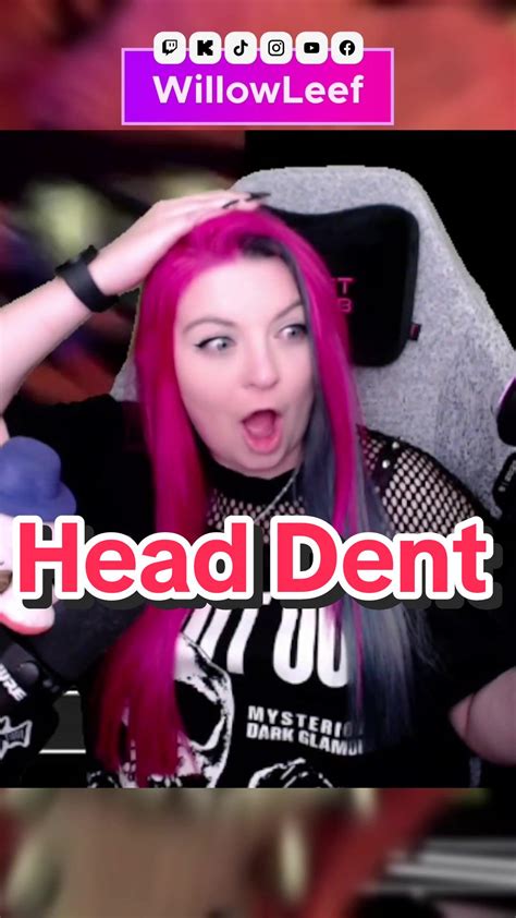 Discovering My Gamer Head Dent Experience | TikTok