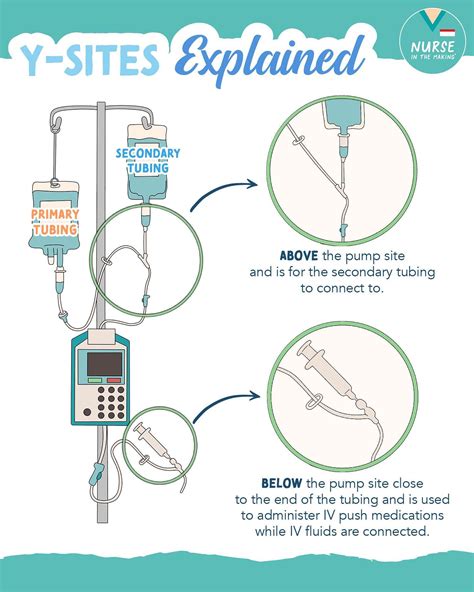 Kristine Tuttle | Y-sites explained – 2 ports stem from your primary IV ...