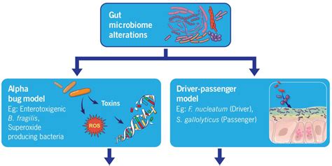 Gut Microbiome–Colorectal Cancer Relationship