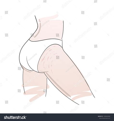 1,609 Stretch Marks Massage Images, Stock Photos & Vectors | Shutterstock