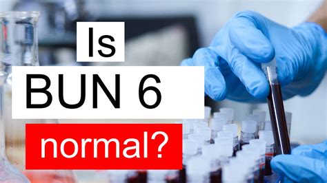 BUN 6 mg/dL: Symptoms you should not ignore | Blood urea nitrogen - bun levels low symptoms