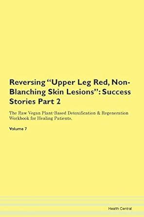 Reversing Upper Leg Red, Non-Blanching S : Central, Health: Amazon.in ...