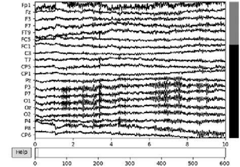 Image result for Convert EDF File to MAT-file