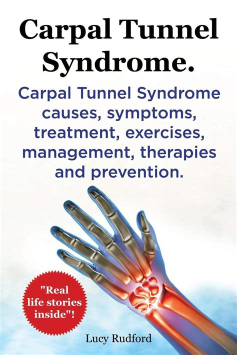Carpal Tunnel Syndrome Cts Carpal Tunnel Syndrome Cts Causes Symptoms ...