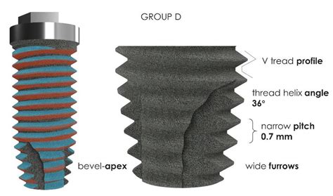 The Effect of Threads Geometry on Insertion Torque (IT) and Periotest ...